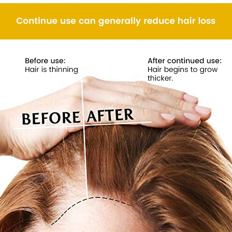 Low Price Ekber Natural Biotin Argan Oil Nourishing Spilt-end Problem Hair Growth Shampoo Conditioner Hair Care Products Bulk
