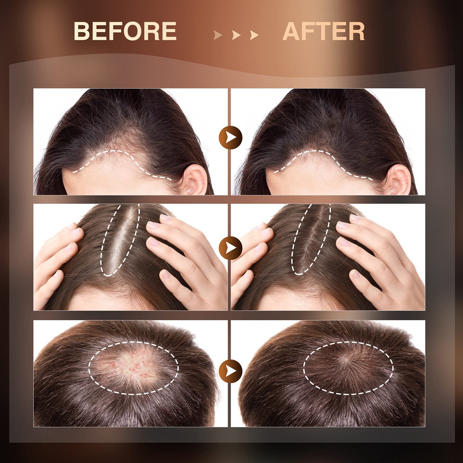 custom vegan hair care loss treatment african american hair growth oil serum vendor for african hair