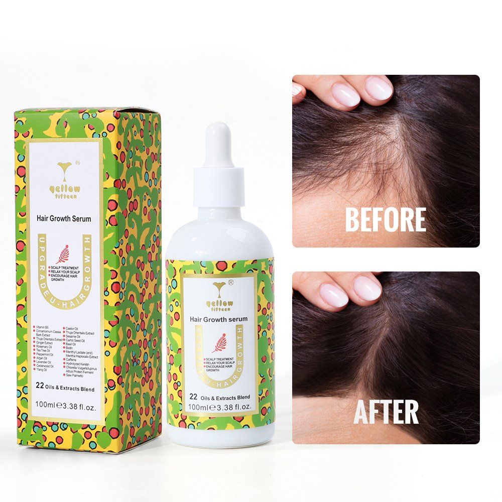 Private Logo Biotin Hair Growth Serum Regrowth Treatment for Scalp Loss Hair Thinning Natural Hair Growth