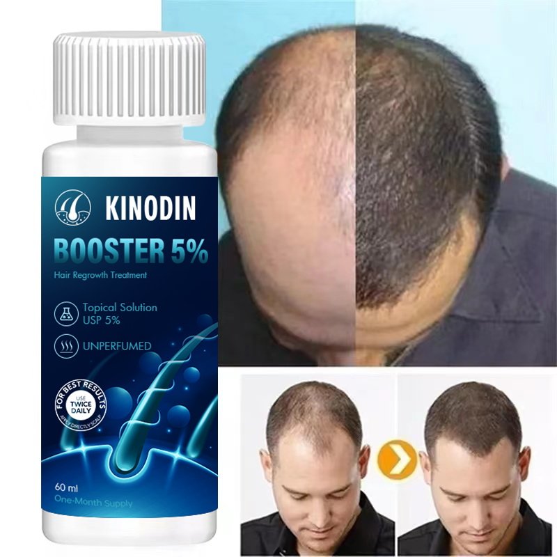 KINODIN Super Fast Hair Growth Serum Tonic hair growth 60ml 5% Prevents Hair Loss Russia xinoxin Growth Serum