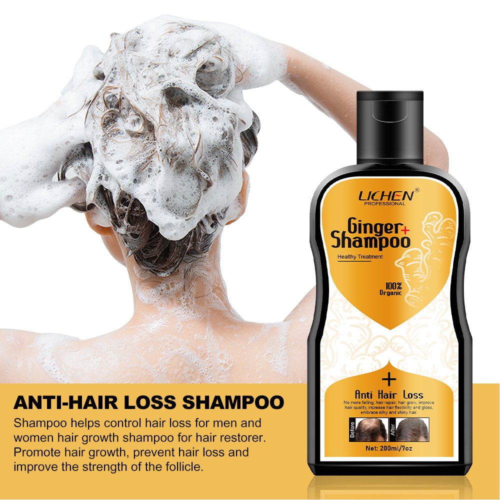 Private label polygonum multiflorum dandruff hair loss shampoo organic hair growth shampoo for thinning hair