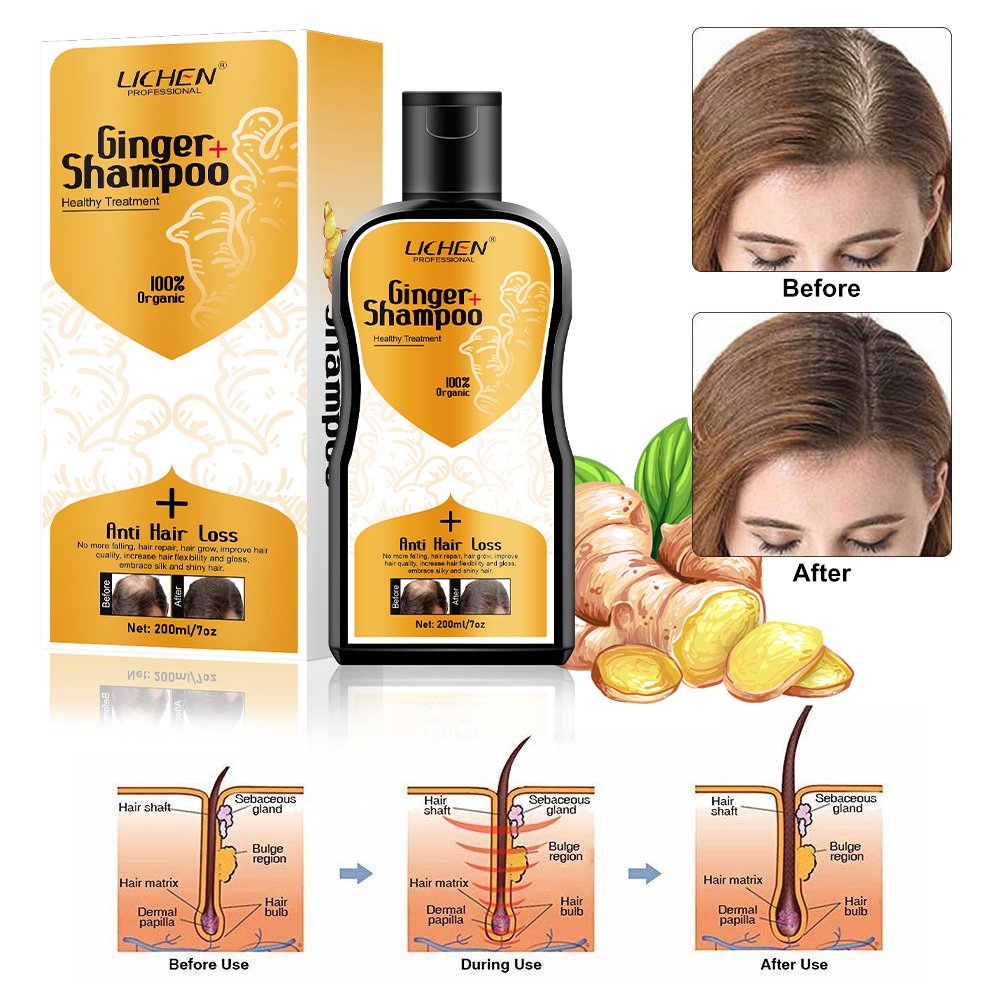 Private label polygonum multiflorum dandruff hair loss shampoo organic hair growth shampoo for thinning hair