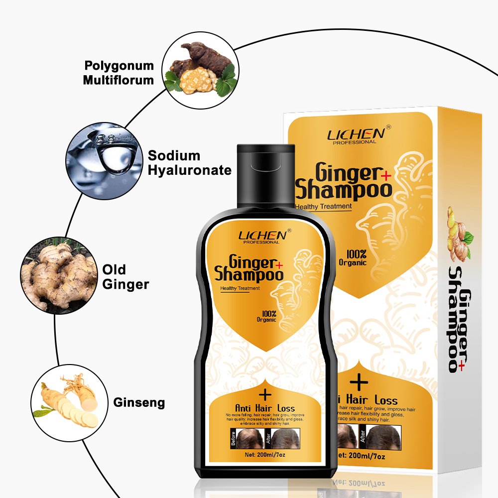 Private label polygonum multiflorum dandruff hair loss shampoo organic hair growth shampoo for thinning hair