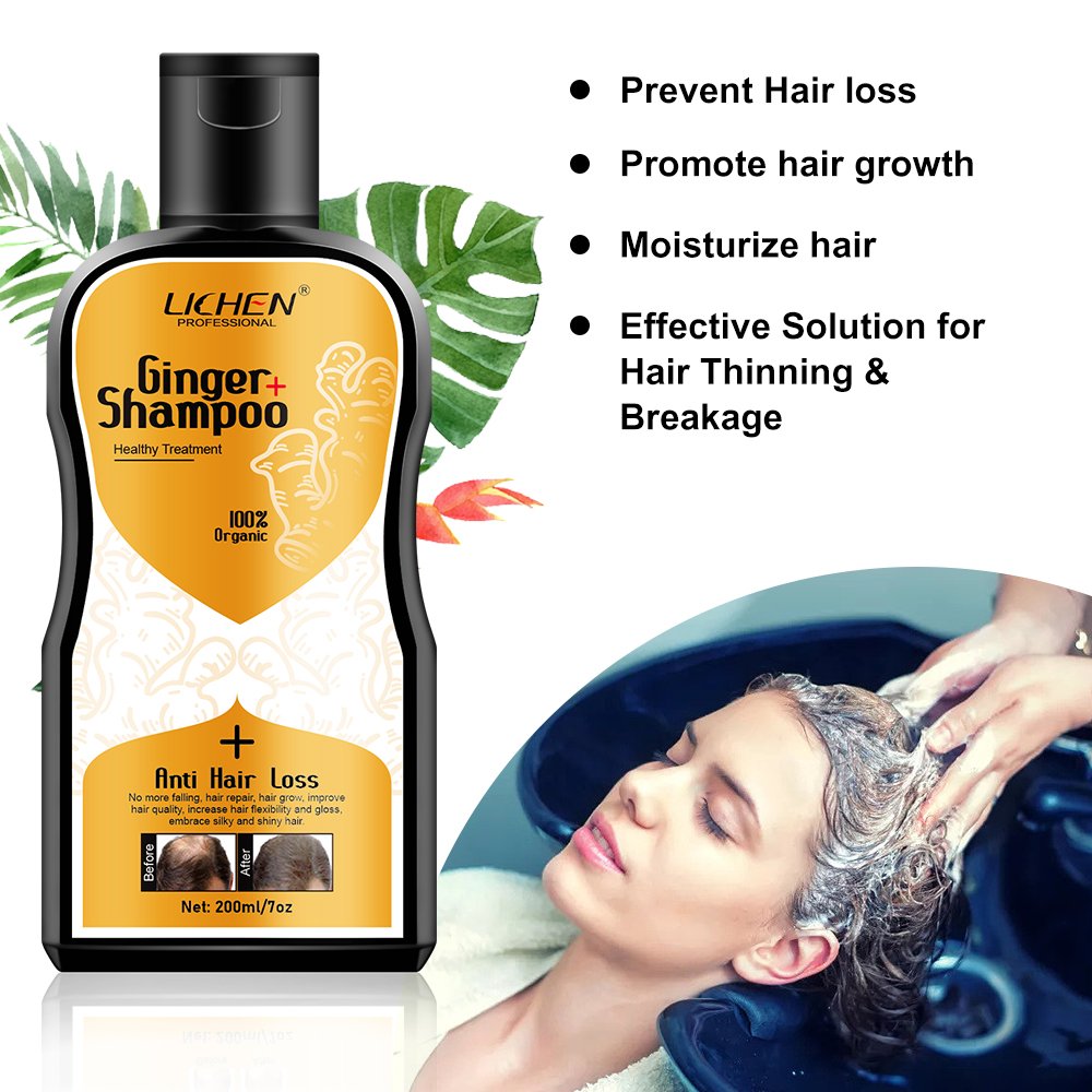 Private label polygonum multiflorum dandruff hair loss shampoo organic hair growth shampoo for thinning hair