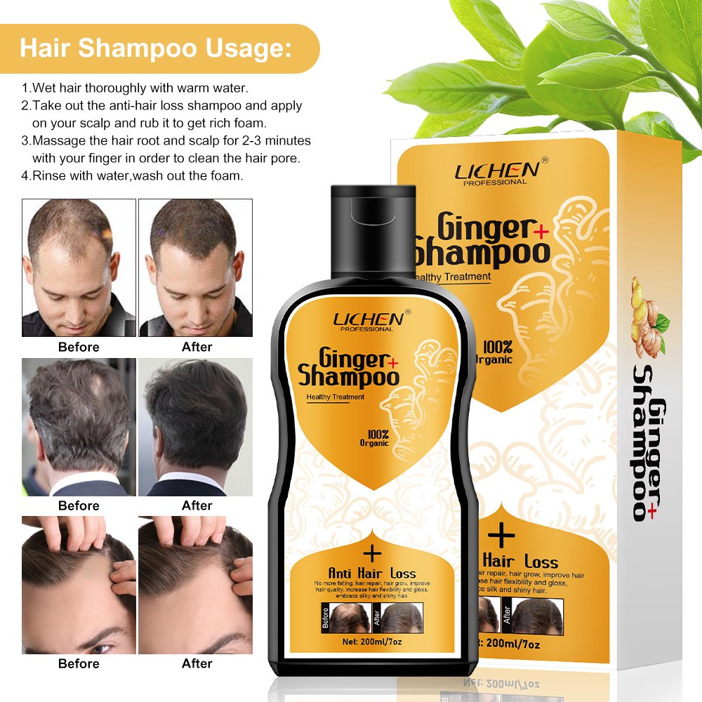 Private label polygonum multiflorum dandruff hair loss shampoo organic hair growth shampoo for thinning hair