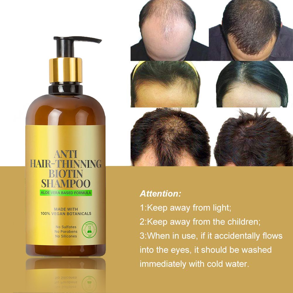 Private Label Best Organic Aloe Vera Strengthens Density Biotin Growing Nourishing Volume Smooth Dandruff Anti Hair Loss Shampoo