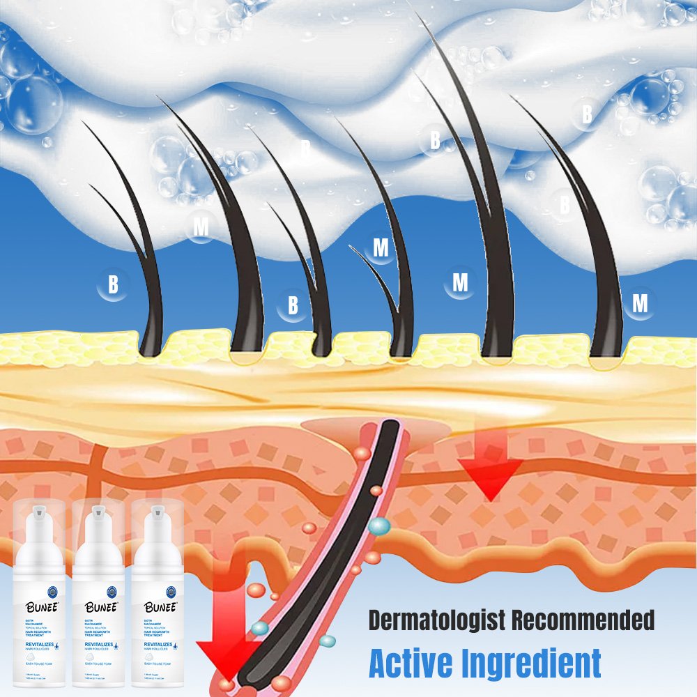 Men's Topical Solution Anti- Hair Loss Rogain Treatment Hair Regrowth Oil Biotin Serum hair growth foam