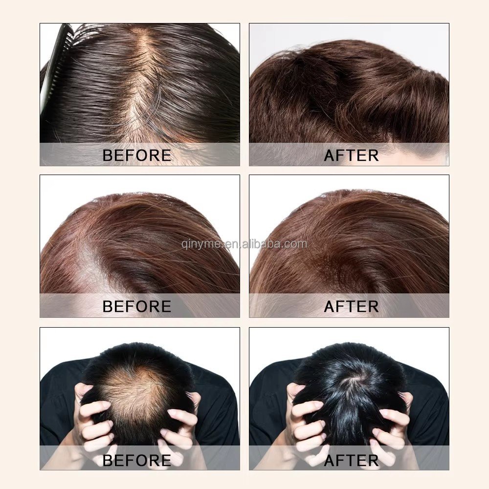 IVS OEM Private Label Wholesale Factory Manufacturer Hair Care Anti Hair Loss Herbal Shampoo For Hair Growth