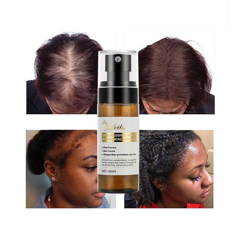 60ml 100% Natural Organic Hair Regrowth Tonics Scalp Serum Massage Oil Hair Growth Spray