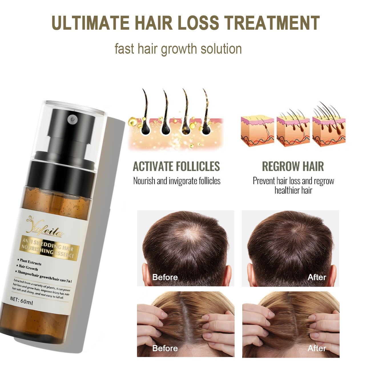 60ml 100% Natural Organic Hair Regrowth Tonics Scalp Serum Massage Oil Hair Growth Spray
