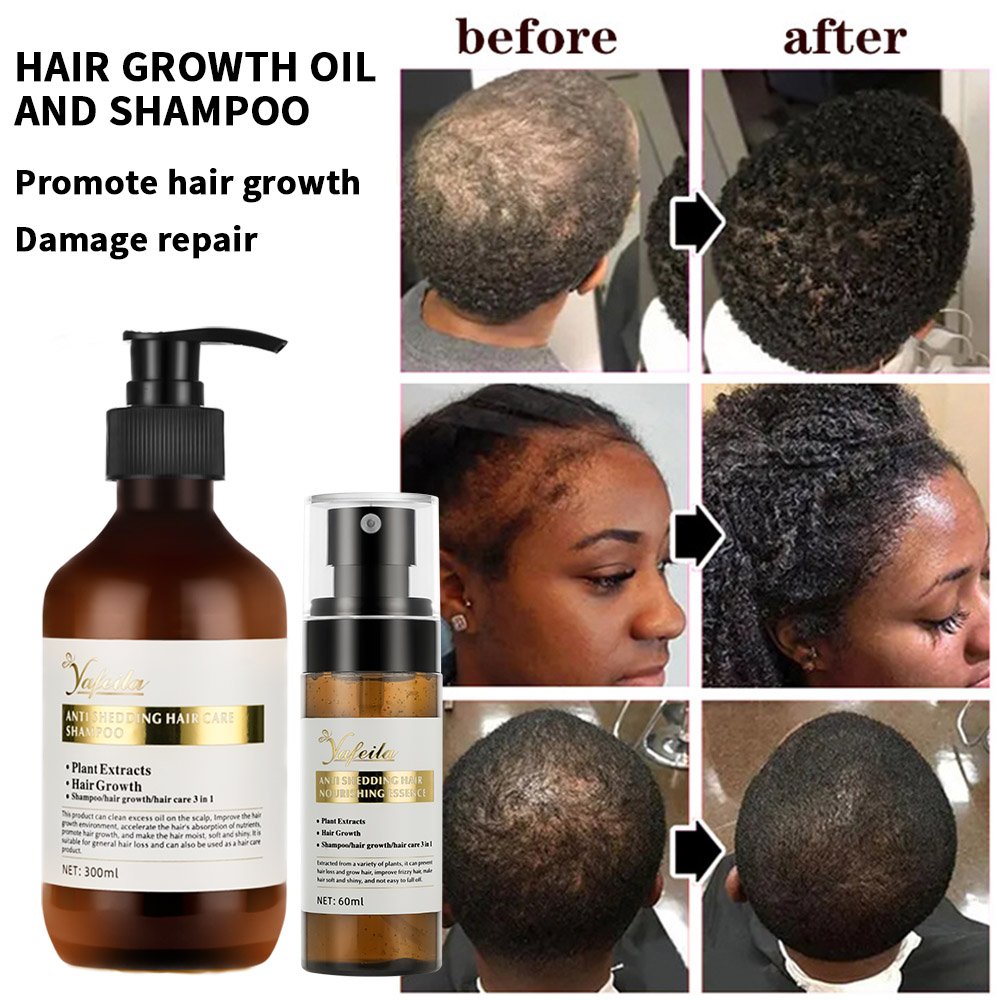 60ml 100% Natural Organic Hair Regrowth Tonics Scalp Serum Massage Oil Hair Growth Spray