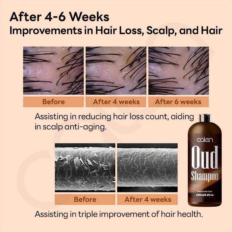 Oalen Custom Logo 250Ml Prevents Dandruff Nourishes Repairs Damaged Hair Oud Shampoo