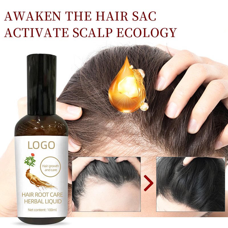 Herbal Hair Loss Prevention Liquid Rapid Hair Growth Promotion Care Liquid 3-in-1 Set