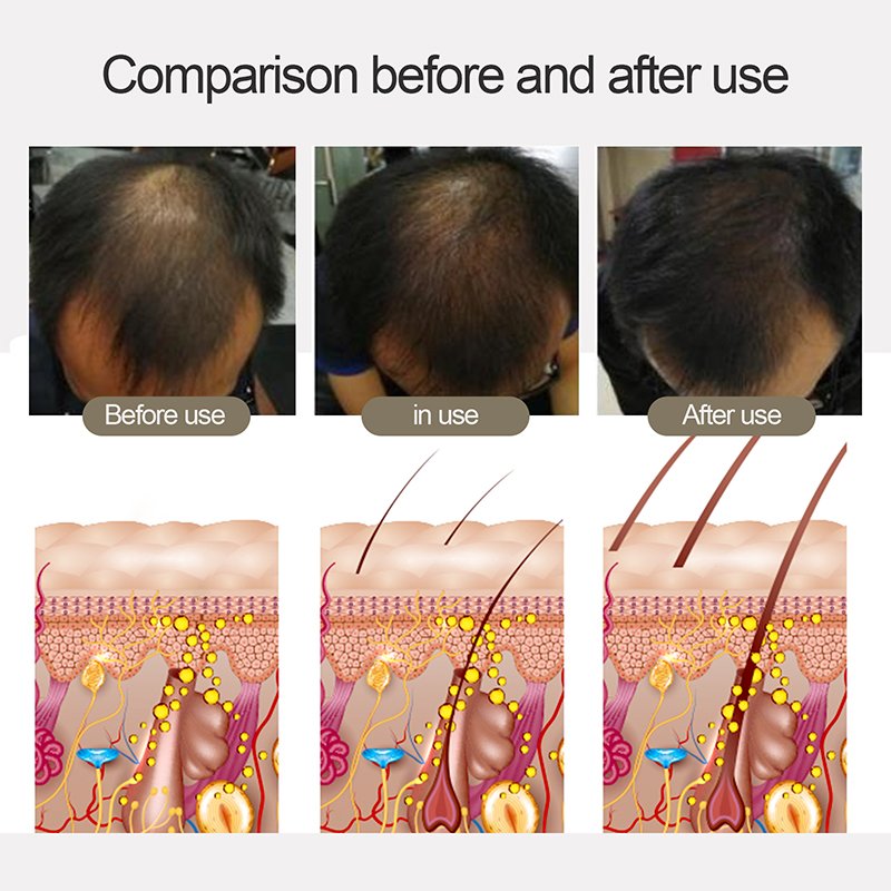 High Quality Hair Shampoo Sulfate-free Oil-Control & Moisturizing and Keratin & Amino acid Ginger Anti Hair Loss Shampoo