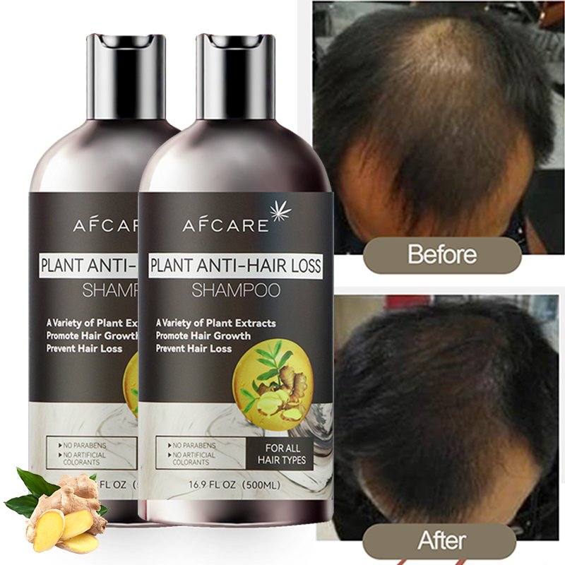 High Quality Hair Shampoo Sulfate-free Oil-Control & Moisturizing and Keratin & Amino acid Ginger Anti Hair Loss Shampoo