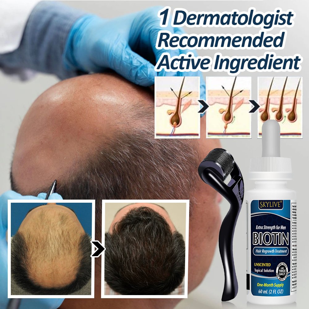 Wholesale Herbals Hair Tonic Liquid Hair Regrowth Anti Hairloss Serum Hair Growth Essential Oil Spray OEM