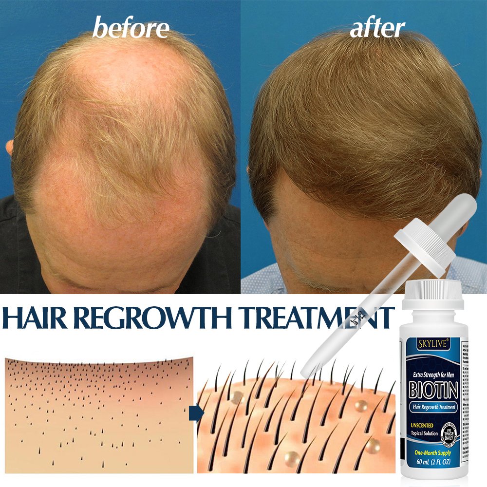 Wholesale Herbals Hair Tonic Liquid Hair Regrowth Anti Hairloss Serum Hair Growth Essential Oil Spray OEM