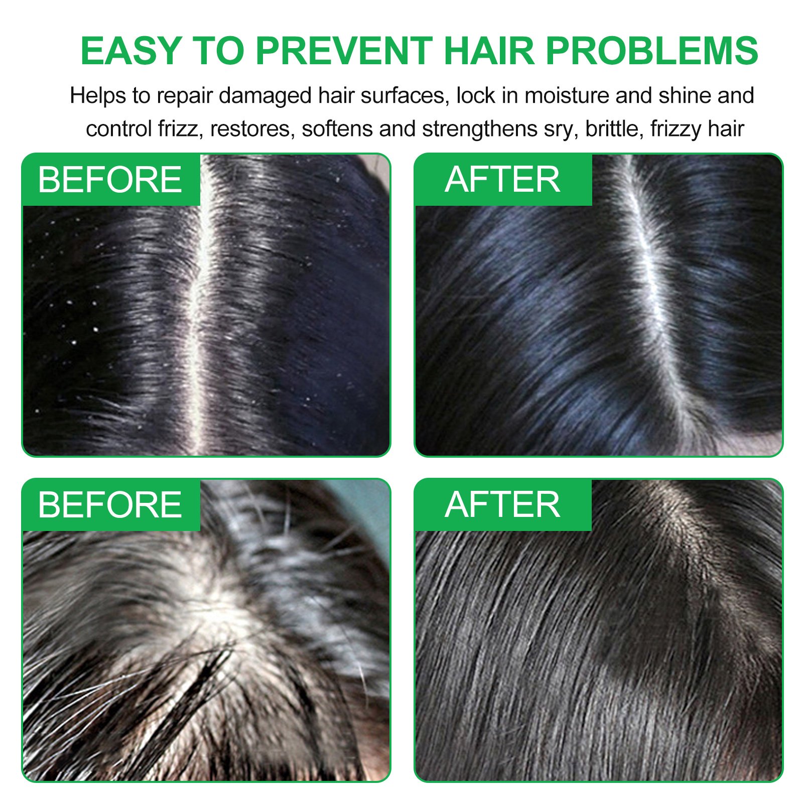 Wholesale Hair Growth Shampoo Bar Soap 100% Natural Organic Nourish Scalp Hair Loss Prevent Rosemary Shampoo Bar