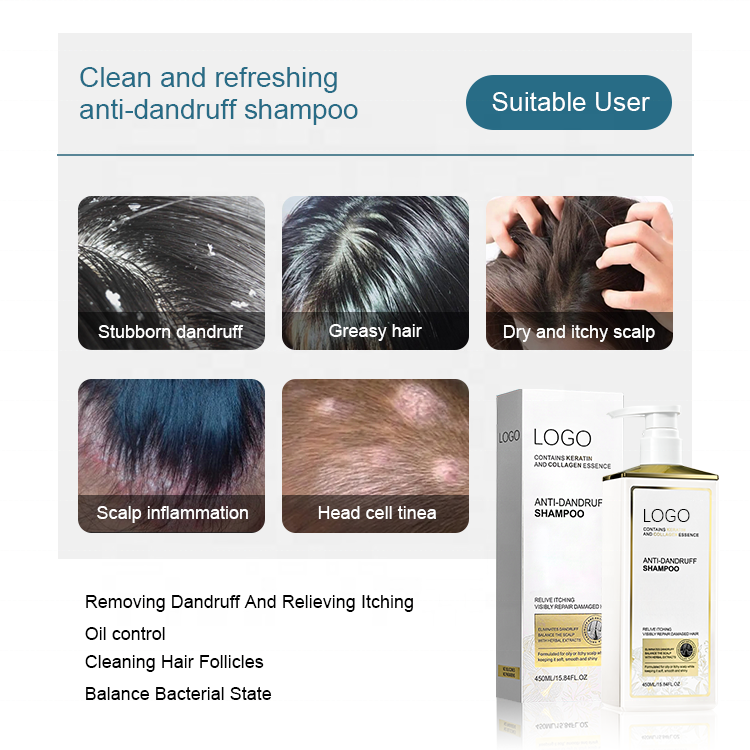 Wholesale Relive Itching Repair Damage Hair Chinese Herbal Anti Dandruff Shampoo