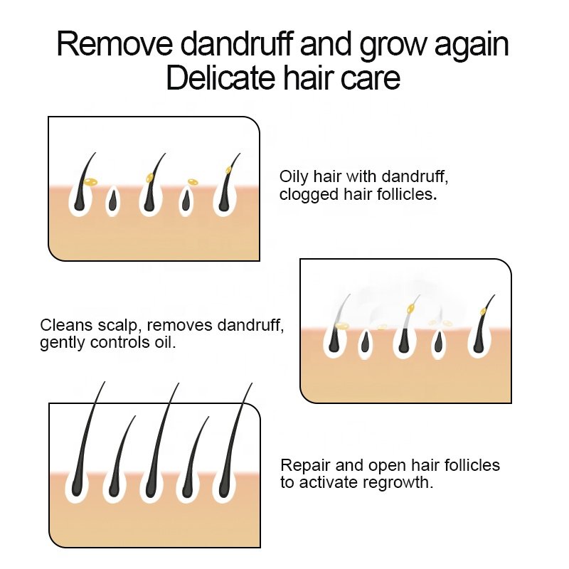 HAIR GROWTH ANTI HAIR LOSS BIONTIN CAFFEINE SHAMPOO