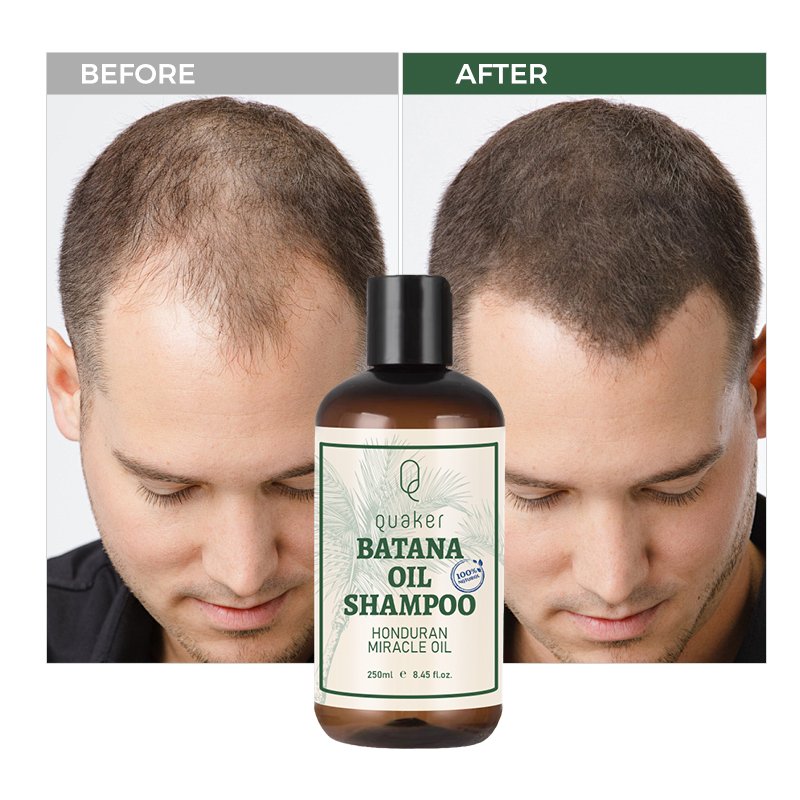 Qquaker Private Label Wholesale Organic Batana Oil Promotes Hair Growth Repair Damaged Hair Shampoo And Conditioner Set