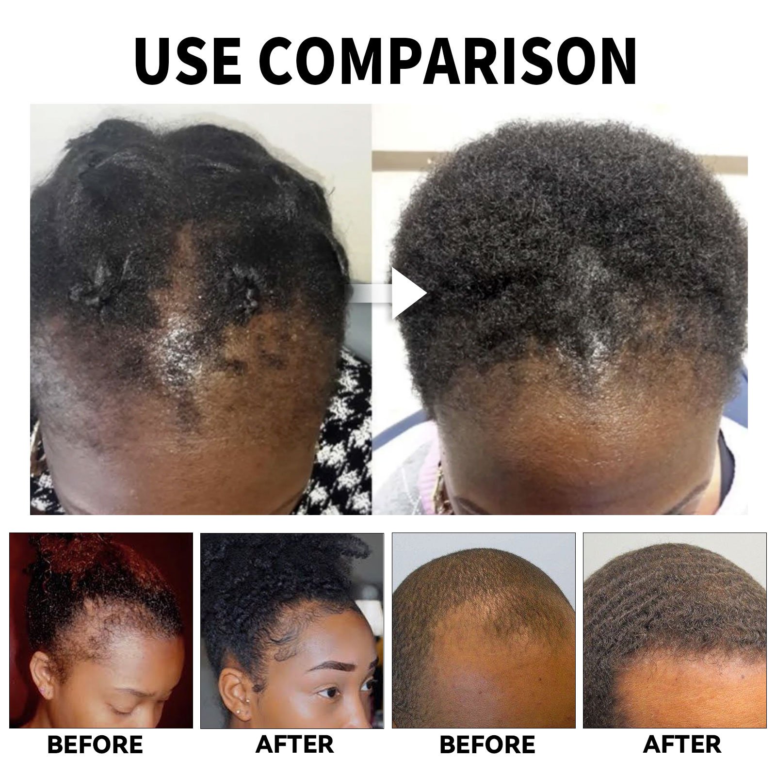 Aromlife private label hair care rosemary olive hair oil organic serum wild fast hair growth oil for black women