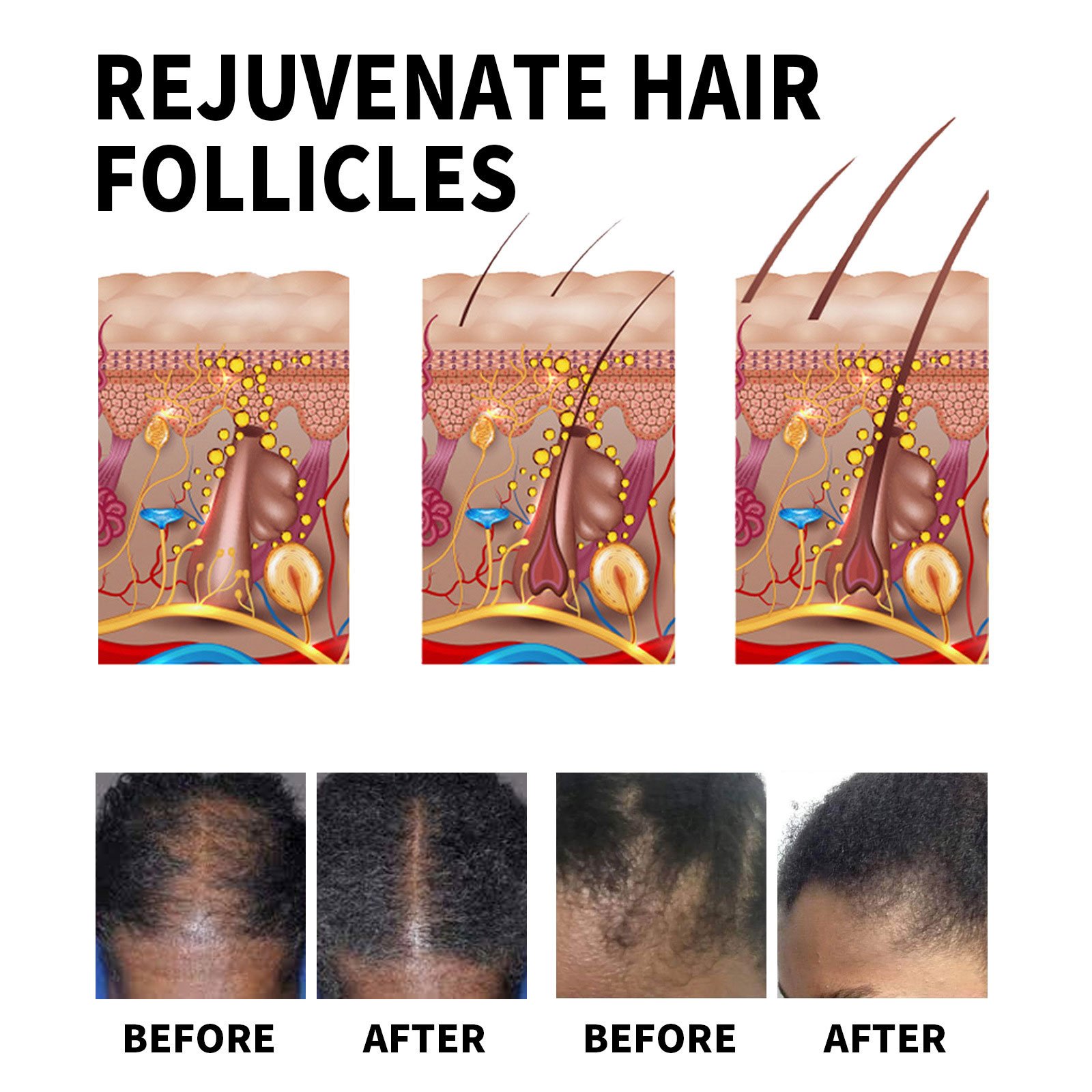 Aromlife private label hair care rosemary olive hair oil organic serum wild fast hair growth oil for black women