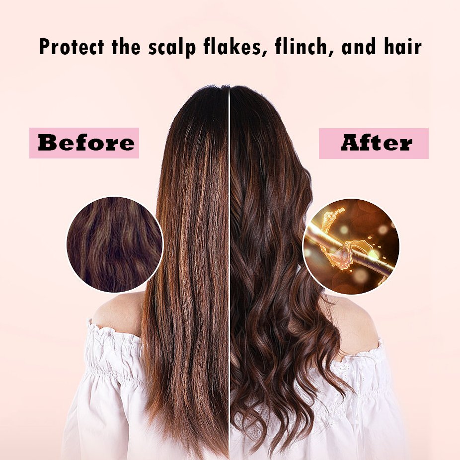 Natural Organic Nourishing Tea Tree Anti Itch Dandruff Hair Care Shampoo And Conditioner