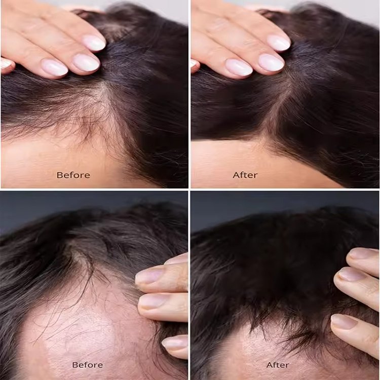 Private Label Strong Shampoo with Rosemary and Mint Oil, Helps Promote Hair Growth and Reduce Hair Loss, for Dry Damaged Hair