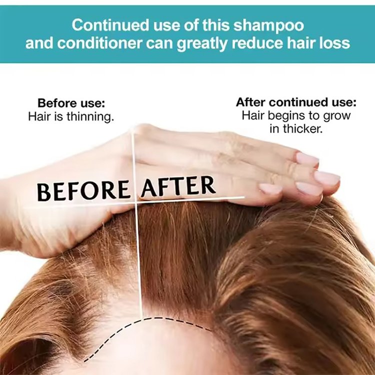 Private Label Strong Shampoo with Rosemary and Mint Oil, Helps Promote Hair Growth and Reduce Hair Loss, for Dry Damaged Hair