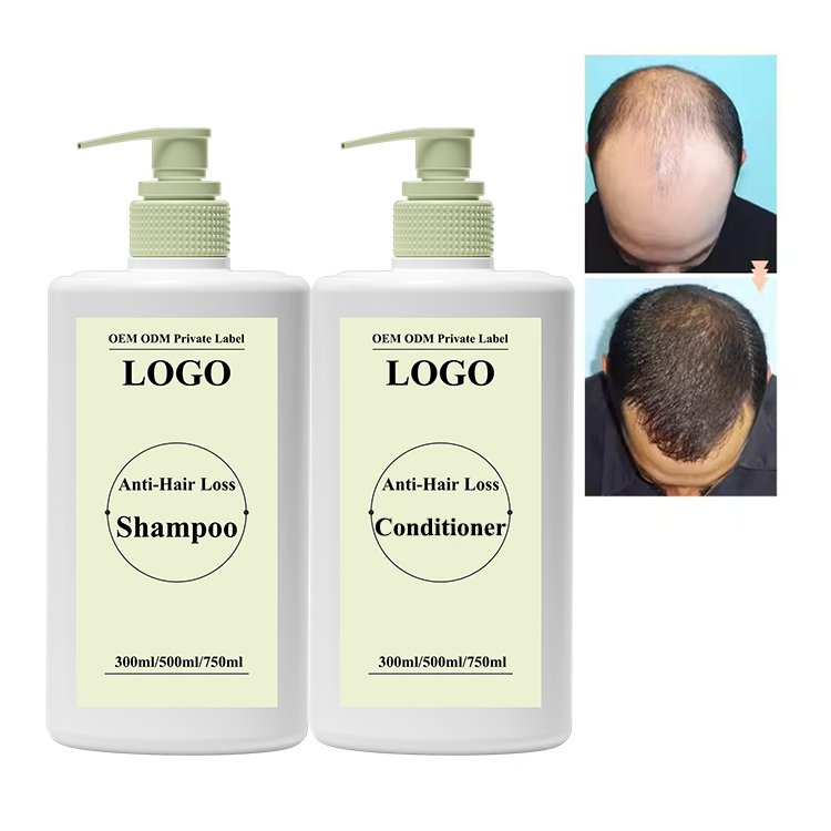 Private Label Strong Shampoo with Rosemary and Mint Oil, Helps Promote Hair Growth and Reduce Hair Loss, for Dry Damaged Hair