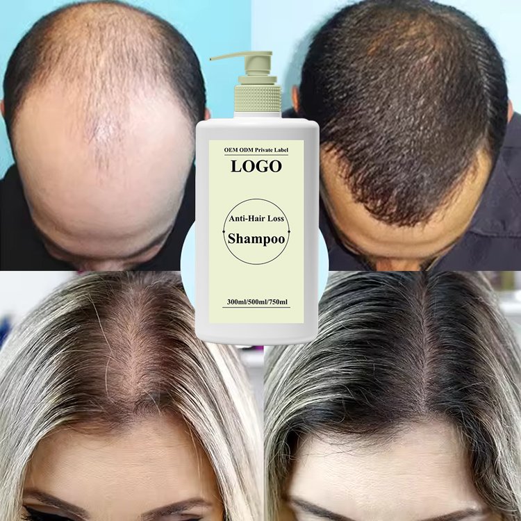 Private Label Strong Shampoo with Rosemary and Mint Oil, Helps Promote Hair Growth and Reduce Hair Loss, for Dry Damaged Hair