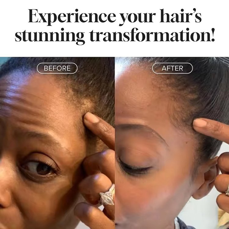 Private Label Strong Shampoo with Rosemary and Mint Oil, Helps Promote Hair Growth and Reduce Hair Loss, for Dry Damaged Hair