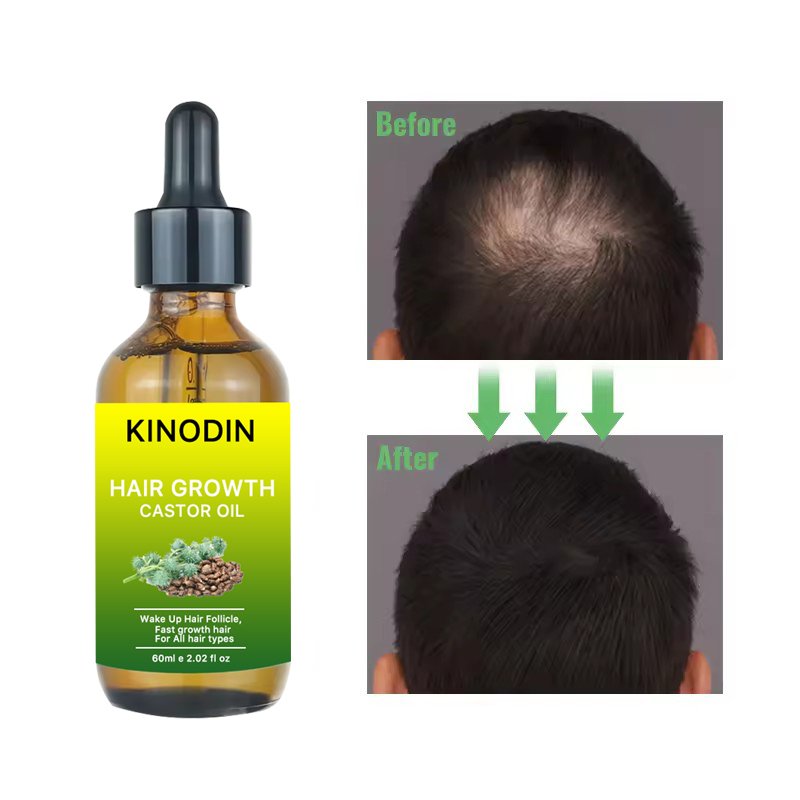 Private Label Natural Batana Oil Organic Promotes Hair Growth Castor oil Repair Damaged Hair Shampoo And Conditioner