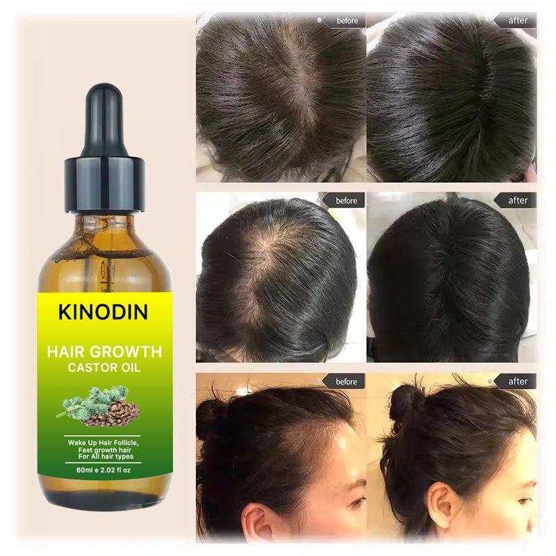Private Label Natural Batana Oil Organic Promotes Hair Growth Castor oil Repair Damaged Hair Shampoo And Conditioner