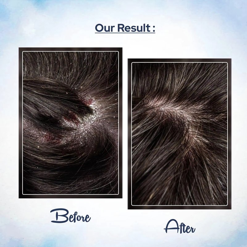 Wholesale Custom Logo Hair Loss Shampoo Private Label OEM ODM Professional Conditioner And Shampoo For Women