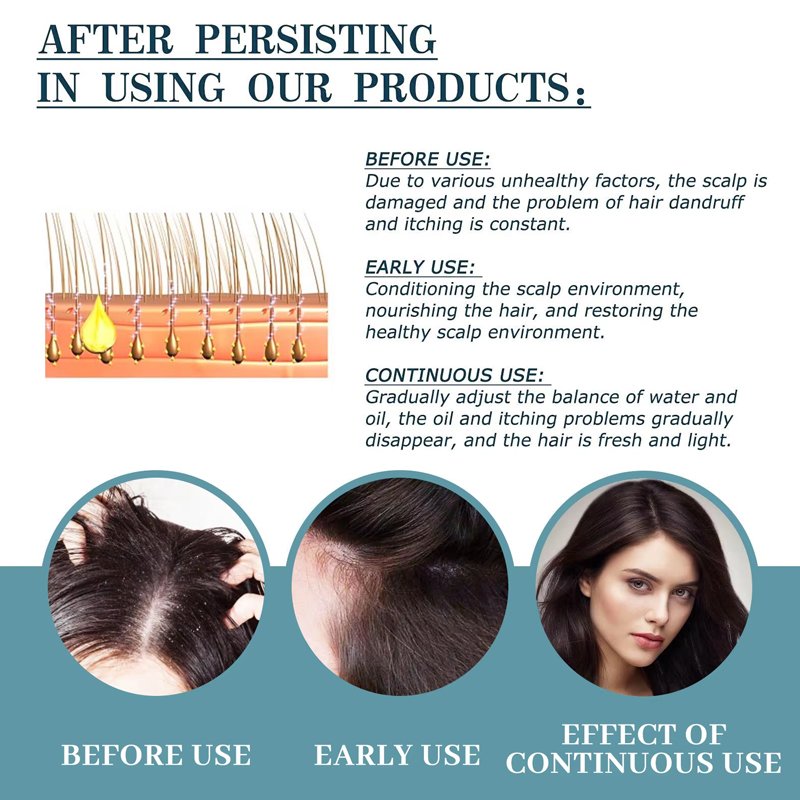 Wholesale Custom Logo Hair Loss Shampoo Private Label OEM ODM Professional Conditioner And Shampoo For Women