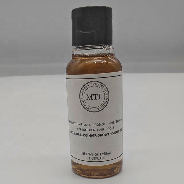 Free sample test Anti-dandruff Hair Care Effective anti-dandruff anti-itching anti-dandruff shampoo