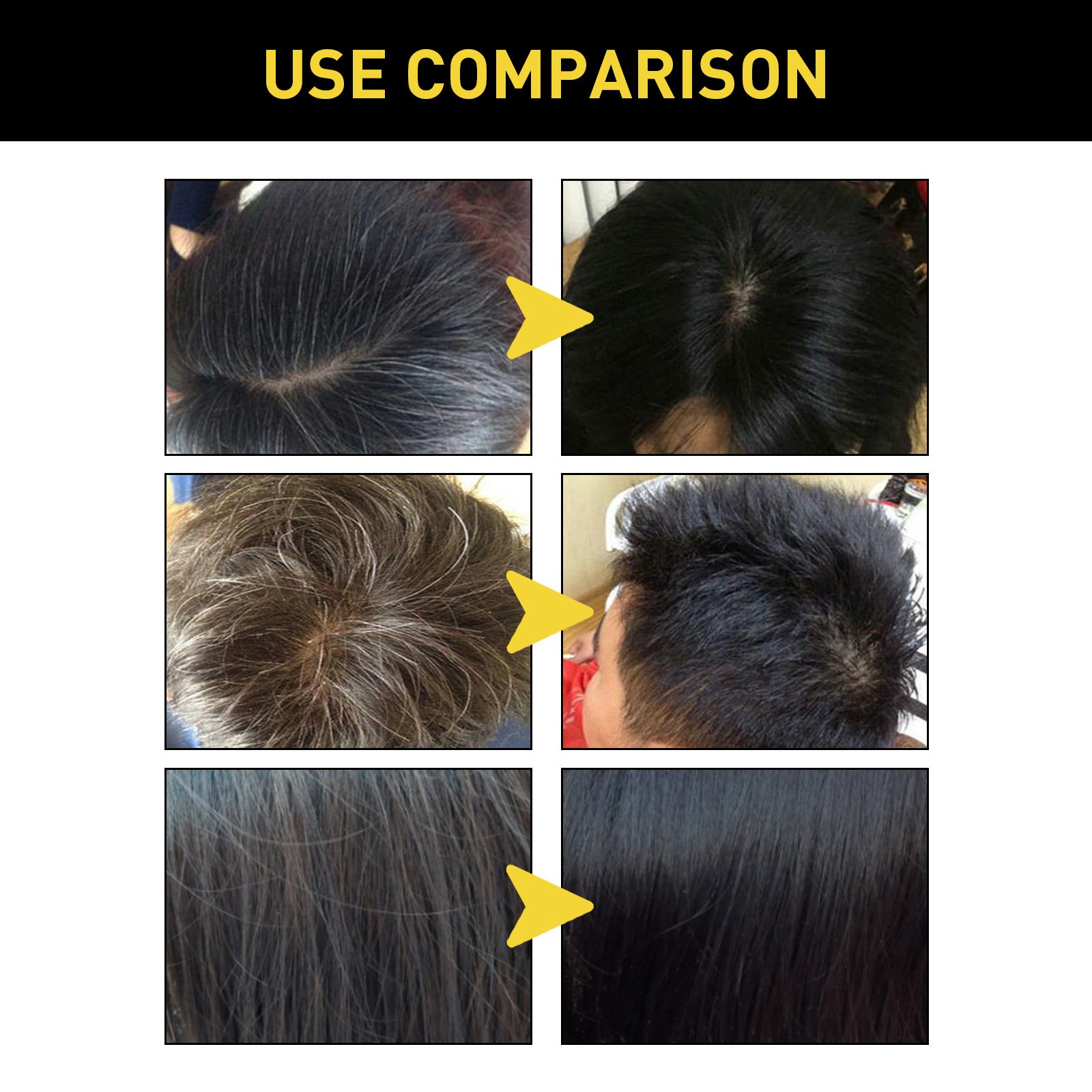 Eelhoe Polygonum Multiflorum Essence Moisturizing Hair Cleaning Repairing Black Softening Shampoo Darking Shampoo
