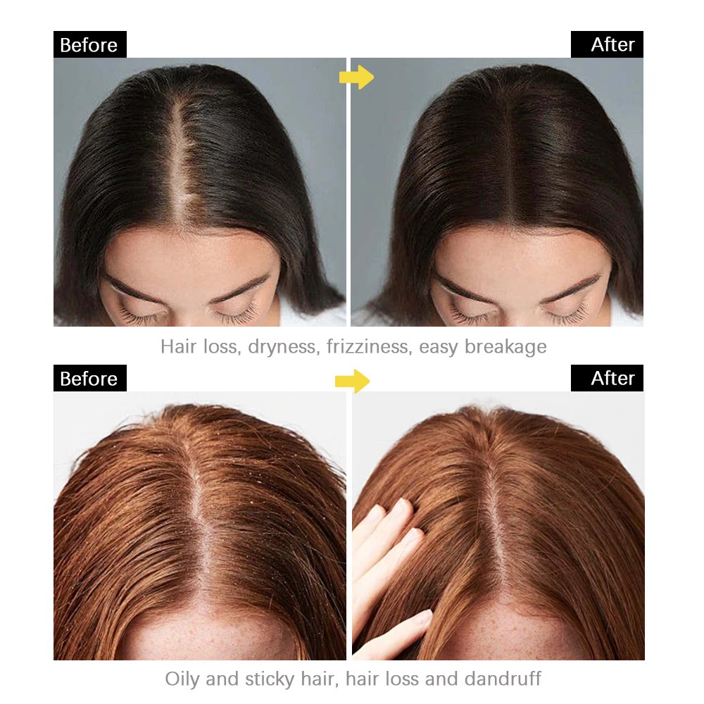 Organic Rosemary Mint Shampoo Strengthens Hair Growth Anti-hair Loss Bio-Hair Amino Acid Herbal Shampoo