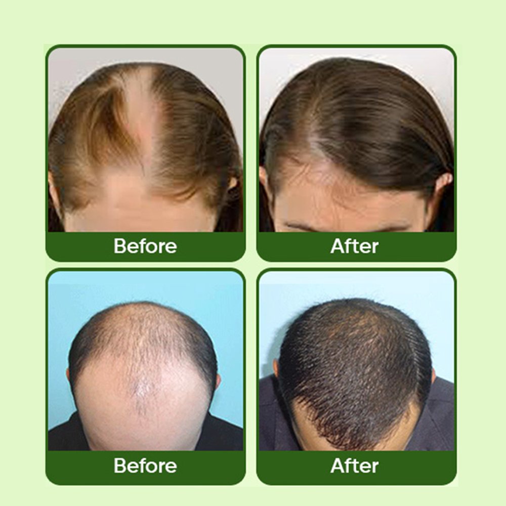 Organic Rosemary Mint Shampoo Strengthens Hair Growth Anti-hair Loss Bio-Hair Amino Acid Herbal Shampoo