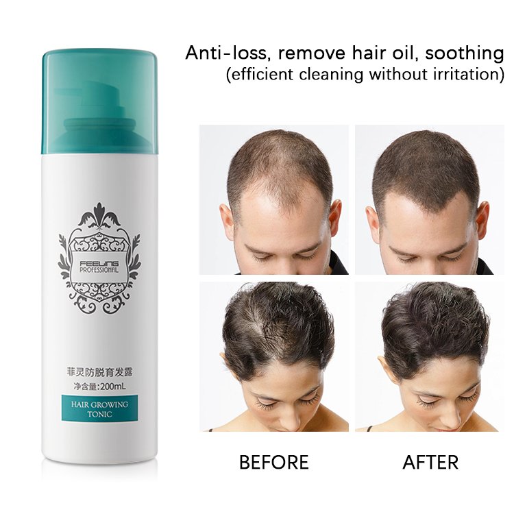 OEM Pro-Hair Growing Tonic 200ml TCM Ingredients Success Hair Regrowth Chinese Government Certificate