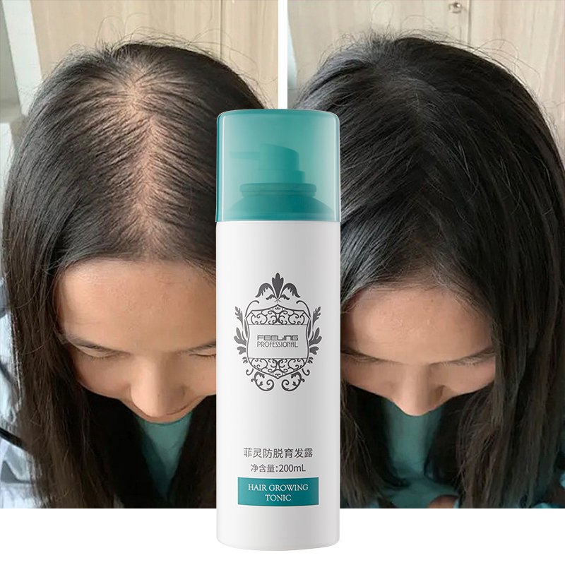 OEM Pro-Hair Growing Tonic 200ml TCM Ingredients Success Hair Regrowth Chinese Government Certificate
