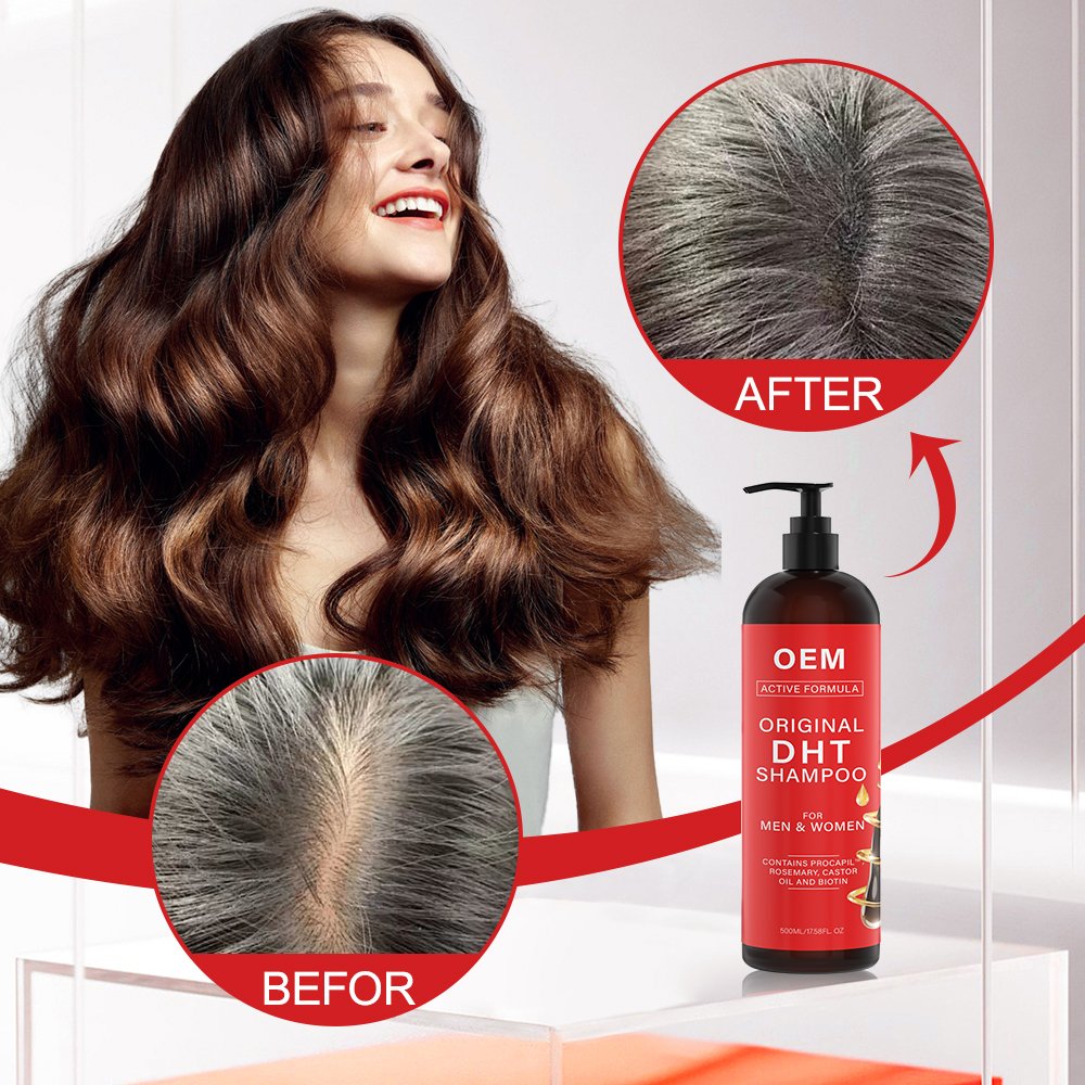 Anti Hair Loss Alopecia DHT Blocker Shampoo Private Label Biotin Rosemary Vitamins Shampoo And Conditioner For Thinning Hair