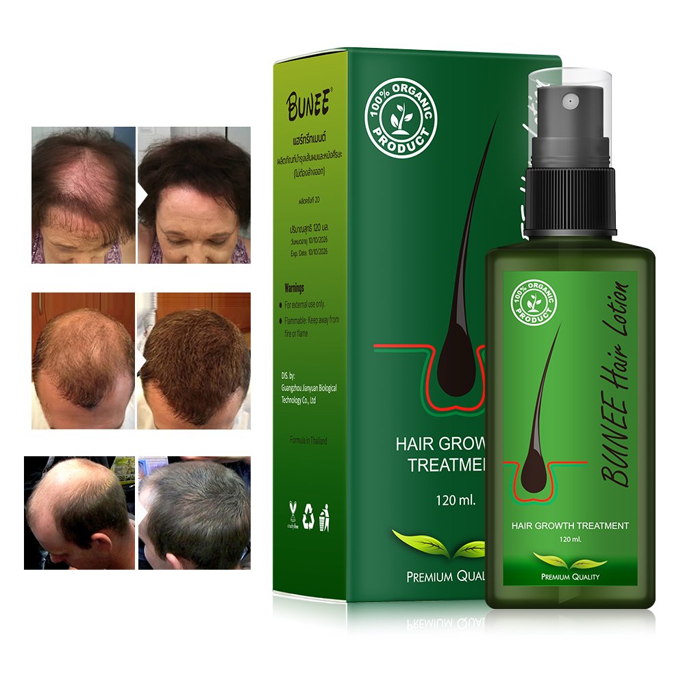 30ml Hair Loss Treatment Serum Hair Oil Nutrient Solution Organic Biotin Growth Serum Hair Growth Oil