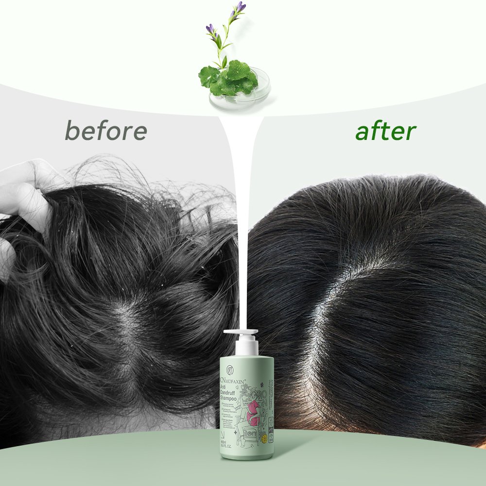 Private label OEM natural organic anti dandruff treatment argan oil biotin shampoo and conditioner for men and women