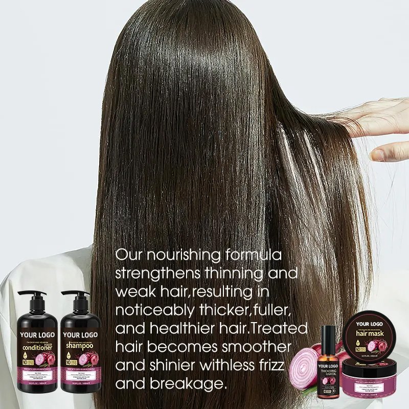 Onion biochemical rosemary shampoos to remove dandruff and repair firing dry dry hair, essential oil hair mask nursing set