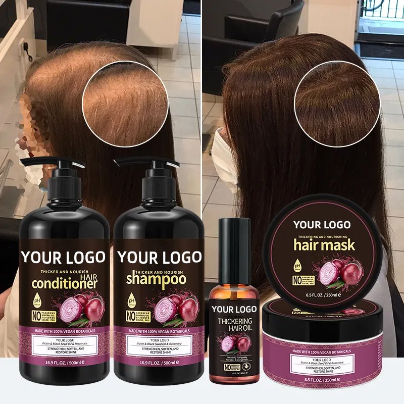 Onion biochemical rosemary shampoos to remove dandruff and repair firing dry dry hair, essential oil hair mask nursing set