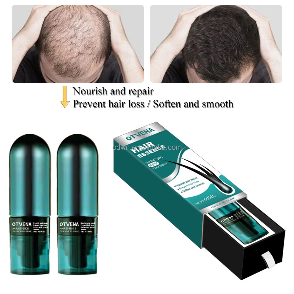 Frizz hair treatment styling OTVENA hair spray Regrowth hair