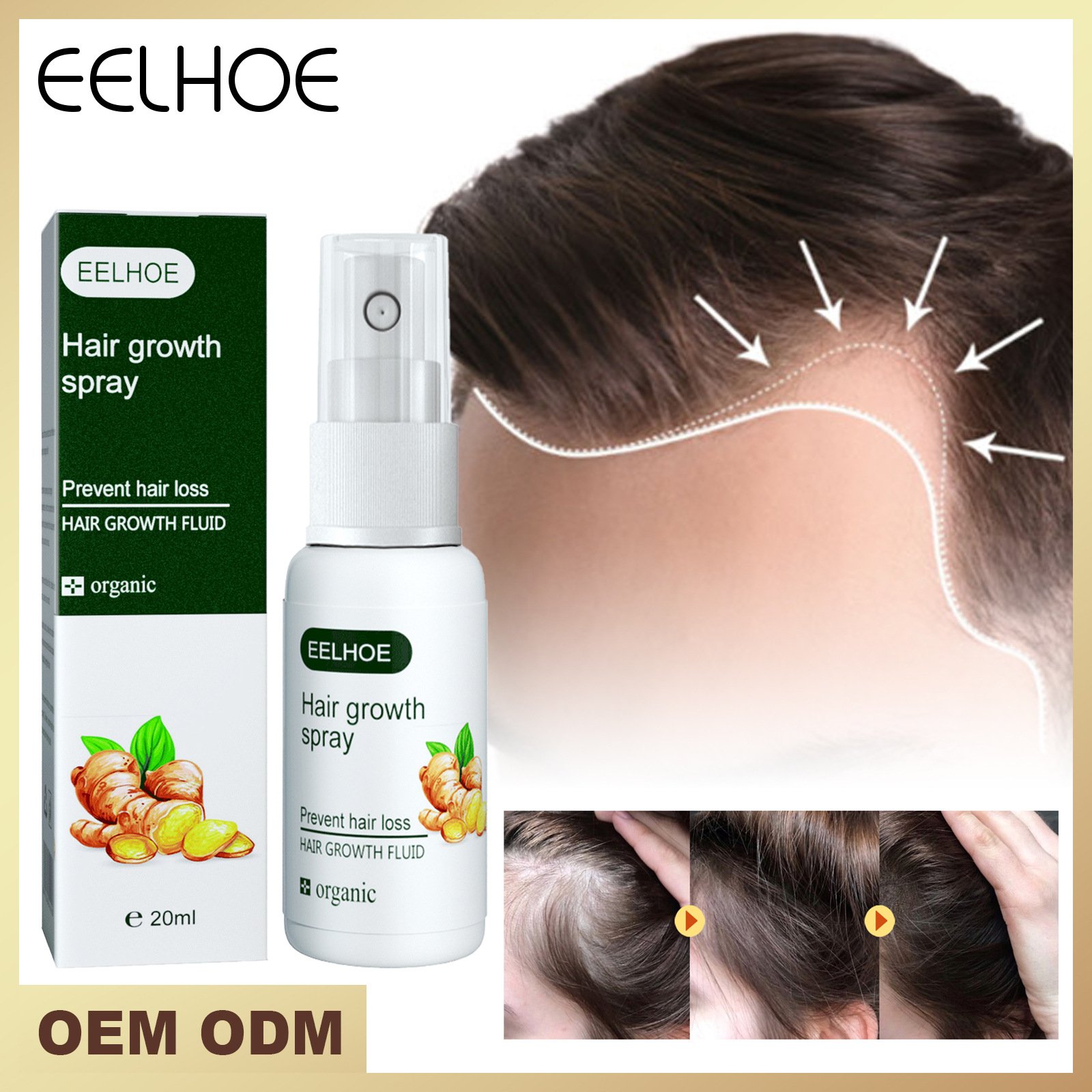 EELHOE Natural Ginger Products Fast Hair Growth Serum Oil Anti Loss Serum Oil Hair Regrowth Conditioners
